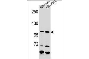 NBN Antibody (C-term) (ABIN655721 and ABIN2845169) western blot analysis in NCI-,NCI- cell line lysates (35 μg/lane). (Nibrin Antikörper  (C-Term))