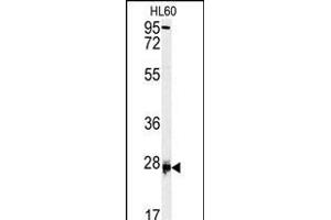 Western blot analysis of DPT antibody (Center) (ABIN391701 and ABIN2841600) in HL60 cell line lysates (35 μg/lane). (Dermatopontin Antikörper  (AA 102-128))