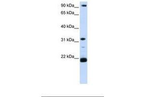 Image no. 1 for anti-Vacuolar-sorting Protein SNF8 (SNF8) (C-Term) antibody (ABIN6739063)