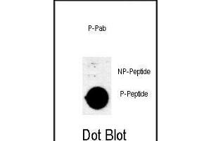 Dot blot analysis of anti-Phospho-AKT1 (Thr308) Antibody Phospho-specific Pab (ABIN650880 and ABIN2839823) on nitrocellulose membrane. (AKT1 Antikörper  (pThr308))