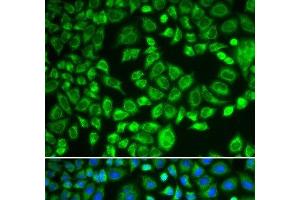 Immunofluorescence analysis of MCF-7 cells using PSMD7 Polyclonal Antibody (PSMD7 Antikörper)