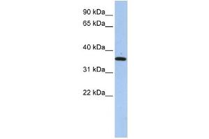 Western Blotting (WB) image for anti-Family with Sequence Similarity 84, Member A (FAM84A) antibody (ABIN2459583) (FAM84A Antikörper)