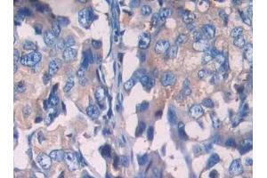 Immunohistochemistry (IHC) image for anti-Single Immunoglobulin and Toll-Interleukin 1 Receptor (TIR) Domain (SIGIRR) (AA 1-118) antibody (ABIN7437203)