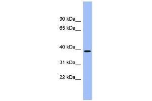 Human kidney; WB Suggested Anti-ACMSD Antibody Titration: 0. (ACMSD Antikörper  (Middle Region))