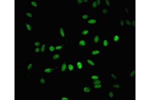 Immunofluorescent analysis of Hela cells using ABIN7171573 at dilution of 1:100 and Alexa Fluor 488-congugated AffiniPure Goat Anti-Rabbit IgG(H+L) (BTAF1 Antikörper  (AA 1750-1849))
