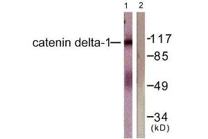 Western Blotting (WB) image for anti-Catenin (Cadherin-Associated Protein), delta 1 (CTNND1) (Tyr228) antibody (ABIN1848016)