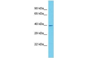 Host: Rabbit Target Name: ANKRD16 Sample Type: Hela Whole cell lysates Antibody Dilution: 1. (ANKRD16 Antikörper  (N-Term))