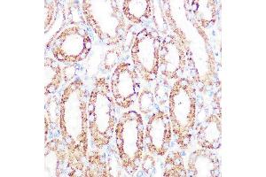 Immunohistochemistry (IHC) image for anti-Dihydrolipoamide Dehydrogenase (DLD) antibody (ABIN7266766)
