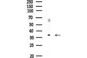 Western blot analysis of lysates from Rat liver, using CDK7 Antibody at 1/1000 dilution.
