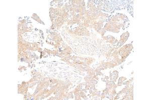 Immunohistochemistry (IHC) image for anti-RPTOR Independent Companion of mTOR, Complex 2 (RICTOR) (C-Term) antibody (ABIN7795814) (Rekombinanter RICTOR Antikörper  (C-Term))