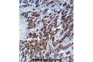Immunohistochemistry (IHC) image for anti-Galectin 3 (LGALS3) antibody (ABIN2995387) (Galectin 3 Antikörper)