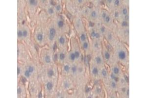 Used in DAB staining on fromalin fixed paraffin- embedded Kidney tissue (PTPRO Antikörper  (AA 948-1205))