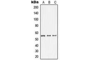 Western blot analysis of GDI1 expression in HepG2 (A), U87MG (B), SHSY5Y (C) whole cell lysates.