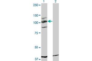 Western Blot analysis of KIT expression in transfected 293T cell line by KIT monoclonal antibody (M05), clone 5F6. (KIT Antikörper  (AA 41-140))