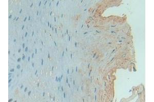 Immunohistochemistry (IHC) image for anti-Serpin Peptidase Inhibitor, Clade G (C1 Inhibitor), Member 1 (SERPING1) (AA 399-500) antibody (ABIN7431428)