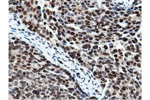 Immunohistochemical staining of paraffin-embedded Human Kidney tissue using anti-NT5DC1 mouse monoclonal antibody. (NT5DC1 Antikörper)
