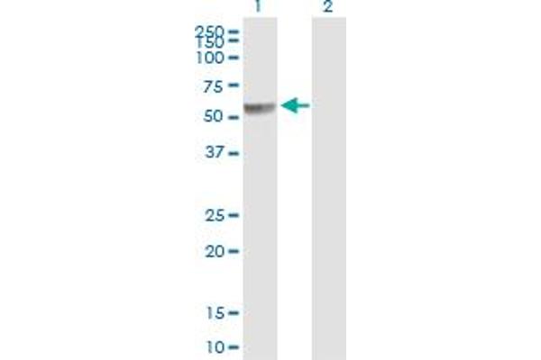 PPP2R5A Antikörper  (AA 1-486)