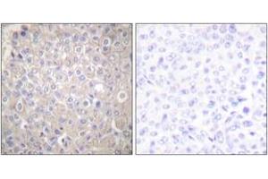 Immunohistochemistry (IHC) image for anti-Cadherin 1, Type 1, E-Cadherin (Epithelial) (CDH1) (AA 1-50) antibody (ABIN1533229)