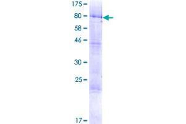 TRMT6 Protein (AA 1-497) (GST tag)