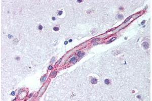 Brain, cortex, capillary (JNK2 Antikörper  (AA 373-389))