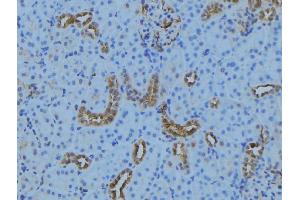 ABIN6279279 at 1/100 staining Mouse kidney tissue by IHC-P. (CEP72 Antikörper)