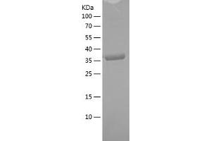 Western Blotting (WB) image for Beclin 1, Autophagy Related (BECN1) (AA 46-152) protein (His-IF2DI Tag) (ABIN7121991) (Beclin 1 Protein (AA 46-152) (His-IF2DI Tag))