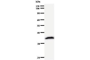 Western Blotting (WB) image for anti-Ribonuclease P/MRP 30kDa Subunit (RPP30) antibody (ABIN933123) (RPP30 Antikörper)