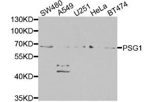 Western blot analysis of extracts of various cells, using PSG1 antibody. (PSG1 Antikörper)