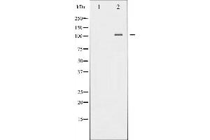 Western blot analysis of NF- kappaB p100/p52 phosphorylation expression in TNF-α treated MDA-MB-435 whole cell lysates,The lane on the left is treated with the antigen-specific peptide. (NFKB2 Antikörper  (pSer870))