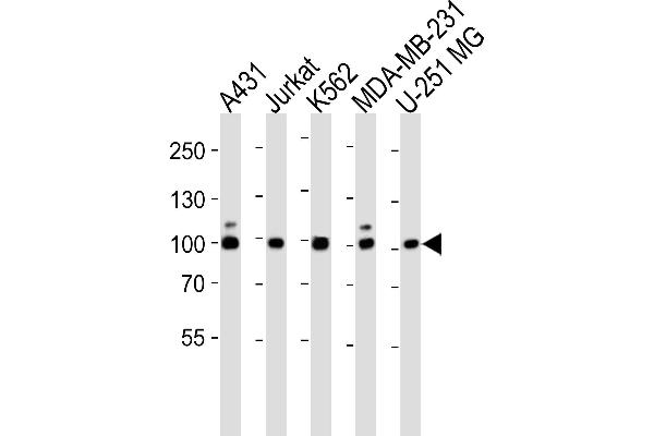 ZNF175 Antikörper  (N-Term)