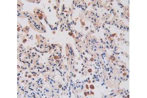 IHC-P analysis of lung tissue, with DAB staining. (IL17RA Antikörper  (AA 377-534))