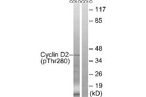 Western blot analysis of extracts from COLO cells, treated with EGF (200ng/ml, 30mins), using Cyclin D2 (Phospho-Thr280) antibody.