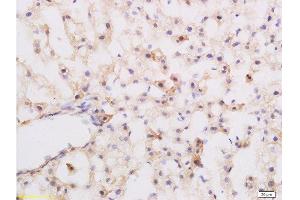 Formalin-fixed and paraffin embedded rat liver labeled with Rabbit Anti-Substance P Polyclonal Antibody at 1:200 followed by conjugation to the secondary antibody and DAB staining. (Substance P Antikörper  (AA 58-68))