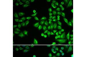Immunofluorescence analysis of MCF-7 cells using PTPN1 Polyclonal Antibody (PTPN1 Antikörper)