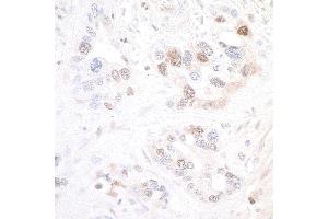 Immunohistochemistry (IHC) image for anti-Nicotinamide phosphoribosyltransferase (NAMPT) (AA 400-450) antibody (ABIN7454014)
