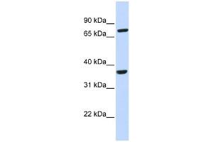 CCRL2 antibody used at 1 ug/ml to detect target protein. (CCRL2 Antikörper)