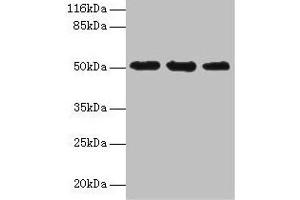 Western blot All lanes: KRT38 antibody at 2 μg/mL Lane 1: MCF-7 whole cell lysate Lane 2: Hela whole cell lysate Lane 3: HepG2 whole cell lysate Secondary Goat polyclonal to rabbit IgG at 1/10000 dilution Predicted band size: 51 kDa Observed band size: 51 kDa (KRT38 Antikörper  (AA 2-456))