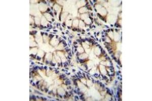 Immunohistochemistry (Paraffin-embedded Sections) (IHC (p)) image for anti-Epithelial Cell Transforming Sequence 2 Oncogene-Like (ECT2L) (AA 732-761), (C-Term) antibody (ABIN952021)