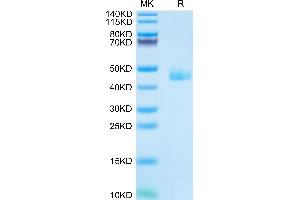 Mouse CCL24 on Tris-Bis PAGE under reduced condition. (CCL24 Protein (AA 27-119) (Fc Tag))
