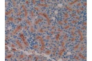 IHC-P analysis of Rat Kidney Tissue, with DAB staining. (Meprin B Antikörper  (AA 433-679))
