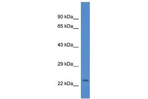 WB Suggested Anti-Csrp2 Antibody   Titration: 1.