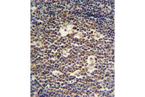 IL4 Antibody (C-term) (ABIN651434 and ABIN2840238) IHC analysis in formalin fixed and paraffin embedded tonsil followed by peroxidase conjugation of the secondary antibody and DAB staining.