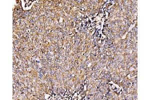 IHC analysis of HIP1R using anti-HIP1R antibody (ABIN7601290).