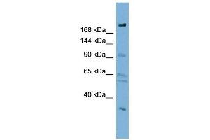 DIP2A antibody used at 1 ug/ml to detect target protein. (DIP2A Antikörper)