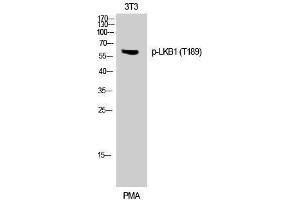 Western Blotting (WB) image for anti-serine/threonine Kinase 11 (STK11) (pThr189) antibody (ABIN3182225) (LKB1 Antikörper  (pThr189))
