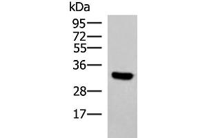 Western blot analysis of Hela cell lysate using KCTD7 Polyclonal Antibody at dilution of 1:1200 (KCTD7 Antikörper)