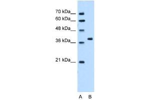 Western Blot showing RUNDC2A antibody used at a concentration of 5. (SNX29 Antikörper  (N-Term))