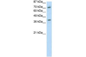 WB Suggested Anti-ZNF282 Antibody Titration: 1. (ZNF282 Antikörper  (C-Term))