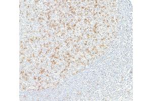 Immunohistochemistry (IHC) image for anti-T Cell Immunoreceptor with Ig and ITIM Domains (TIGIT) (AA 194-244) antibody (ABIN7449559)