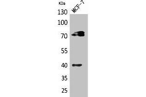 Western Blot analysis of MCF7 cells using CD110 Polyclonal Antibody. (MPL Antikörper  (Internal Region))